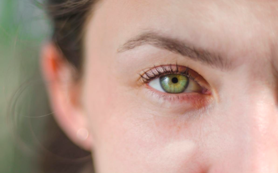 What's special about green eyes? 10 fascinating facts about green eyes