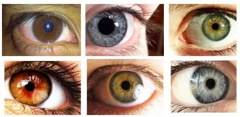 Can people have amber eyes?