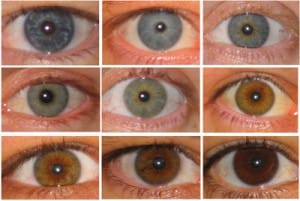 Can people have amber eyes?